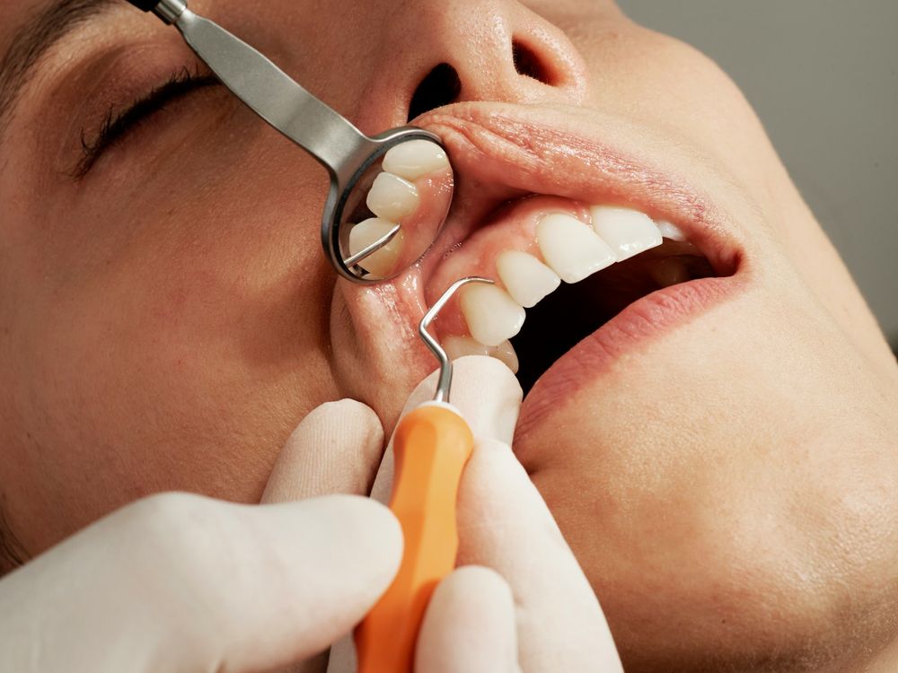 Profissional examinando os dentes de um paciente
